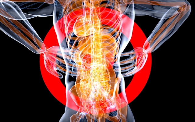 Musculoskeletal Conditions